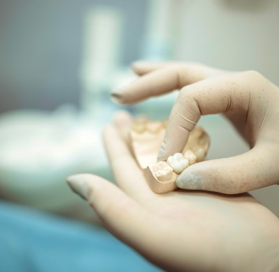 Crowns Treatment In Walton Way Ext., Augusta, Georgia